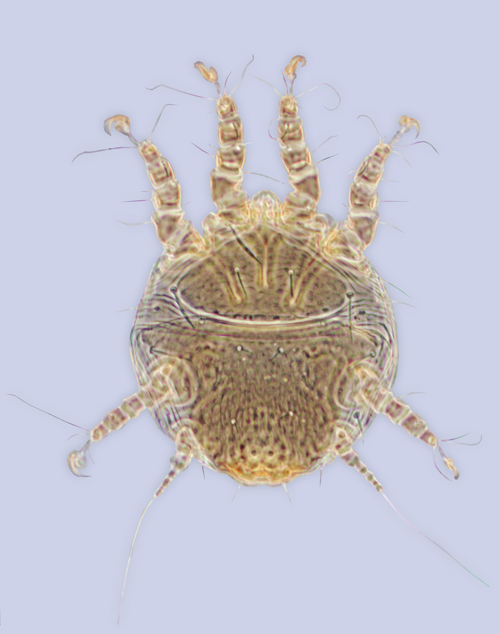 Chaetodactylus gibbosi, phoretic deutonymph (holotype), ex Lithurgus gibbosus, Florida, BMOC 02-1205-006