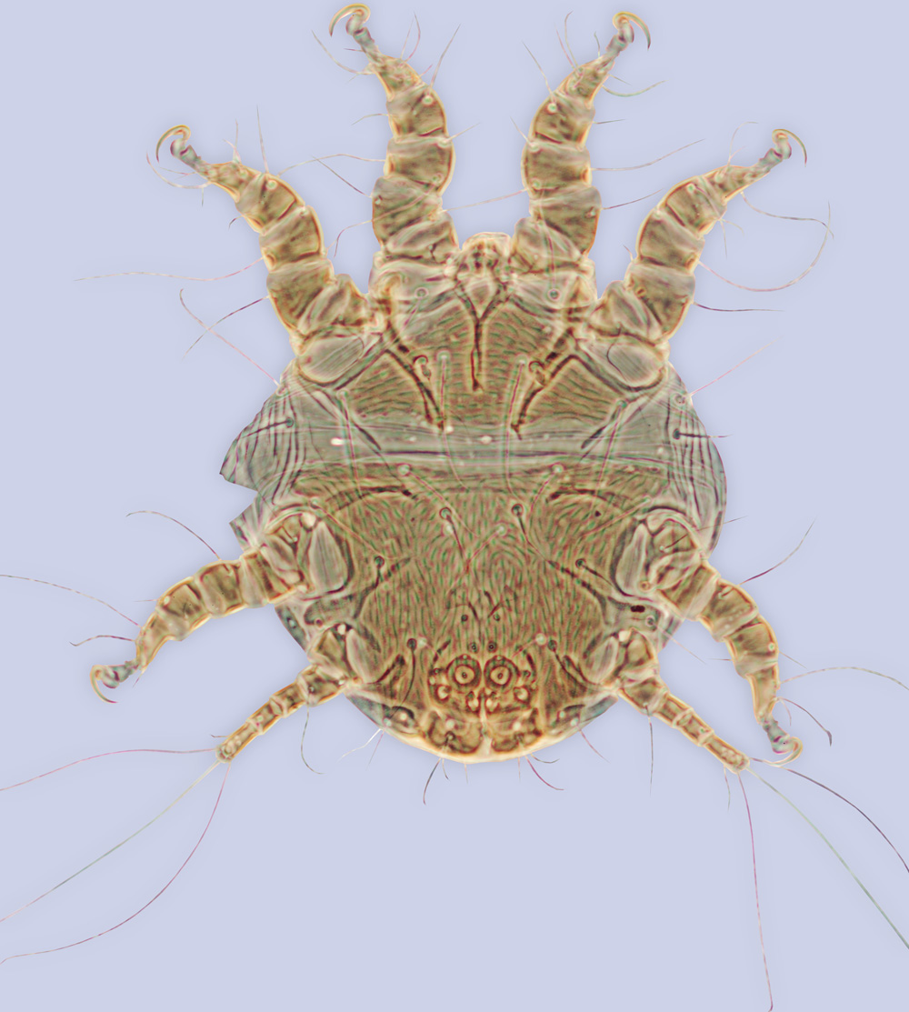 Chaetodactylus hopliti, phoretic deutonymph (holotype), ex Hoplitis producta, New York, BMOC 84-0409-001