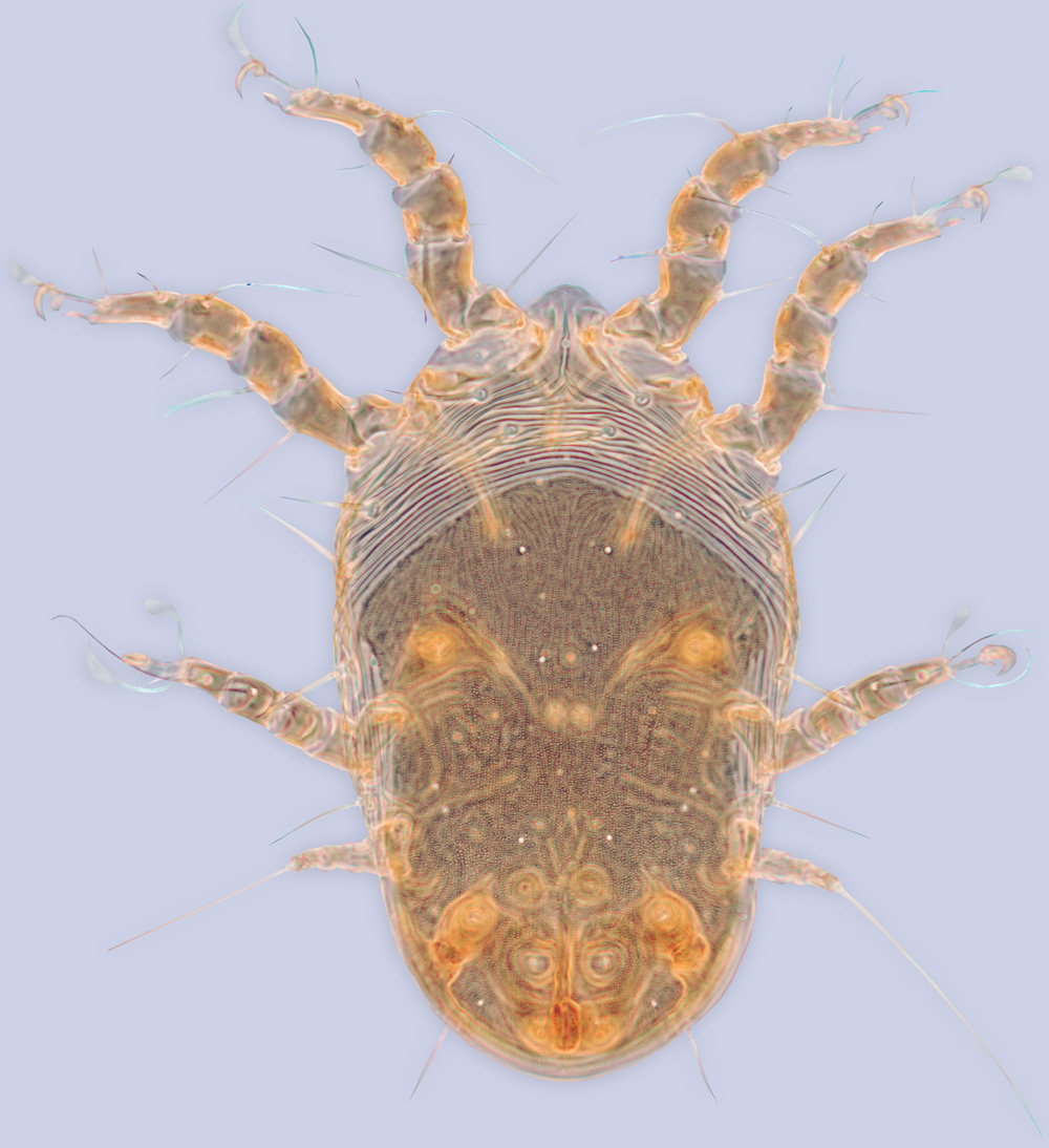 <I>Sennertia haustrifera</I>, phoretic deutonymph, ex <I>Ceratina capitosa</I>, Mexico, BMOC 97-0331-035